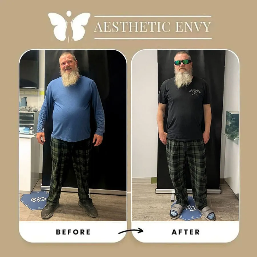 semaglutide sacramento ca Semaglutide Weight Loss in Sacramento and Folsom, CA