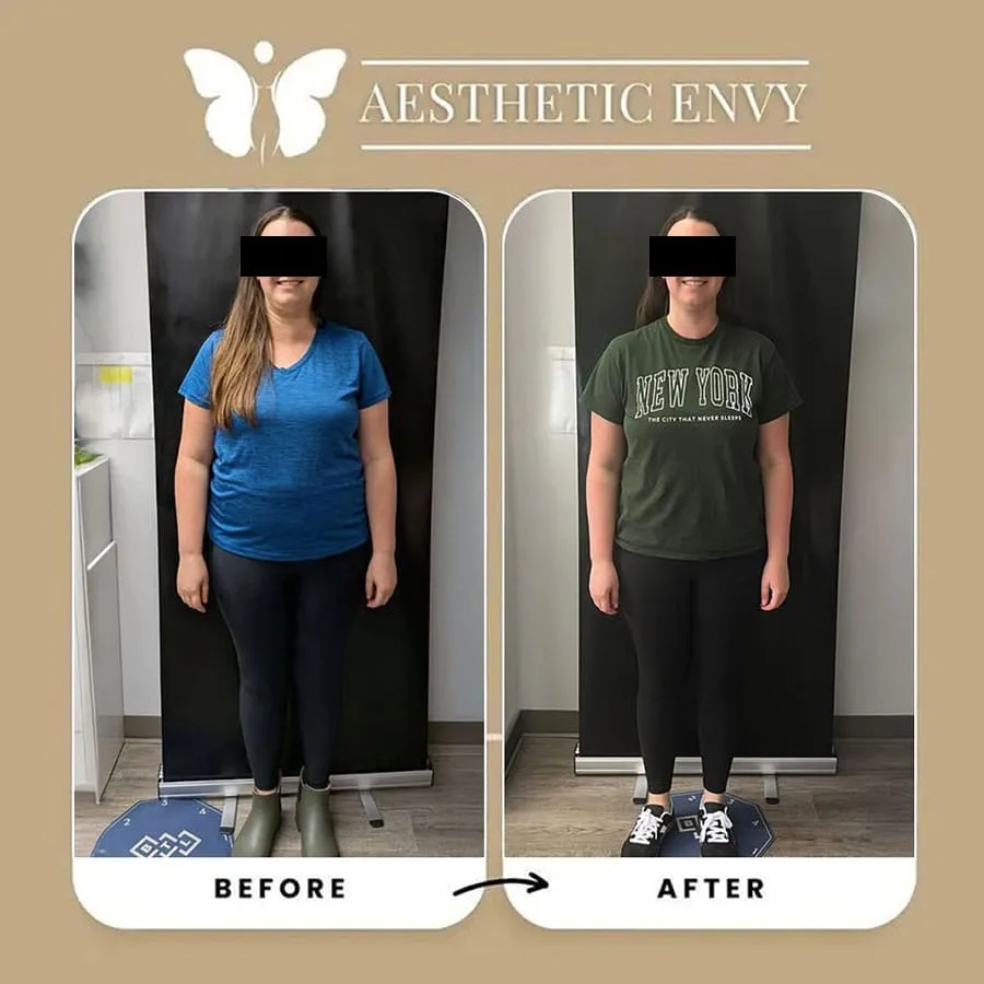 sacramento semaglutide injections Semaglutide Weight Loss in Sacramento and Folsom, CA