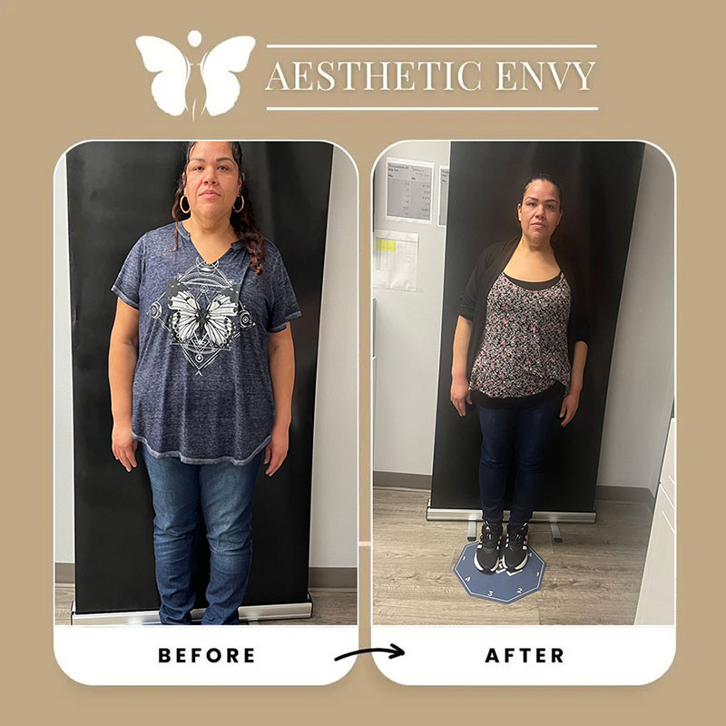 Before and after medical weight loss results at a Roseville clinic.