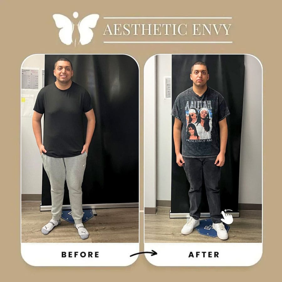 Semaglutide progress images highlighting weight loss results in Roseville.