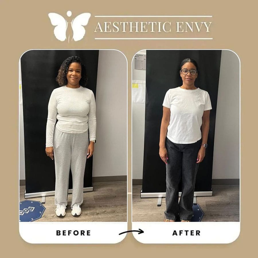 Before and after images documenting Semaglutide weight loss in Roseville, CA.